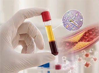 Lipid Metabolism & Uric Acid Disorders